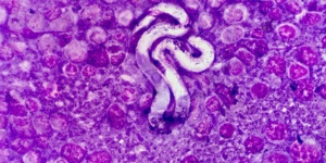 Dirofilaria immitis